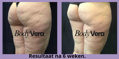 files/Before_and_after_3_bodyvera_new_paars.png