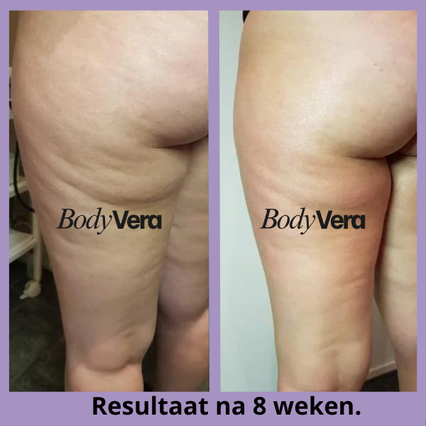 files/Body_Vera_Before_and_after_1_new_paars.png